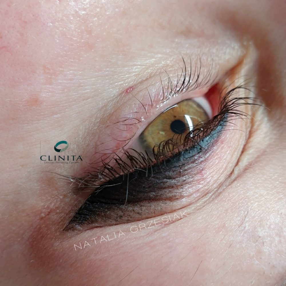 20210301_171044_mr1614615153494